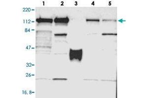 Western blot analysis of Lane 1: RT-4, Lane 2: U-251 MG, Lane 3: Human Plasma, Lane 4: Liver, Lane 5: Tonsil with PPFIBP1 polyclonal antibody  at 1:250-1:500 dilution. (PPFIBP1 Antikörper)