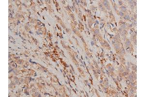 Immunohistochemistry (IHC) image for anti-conserved Helix-Loop-Helix Ubiquitous Kinase (CHUK) (pSer176), (pSer177) antibody (ABIN6256173)