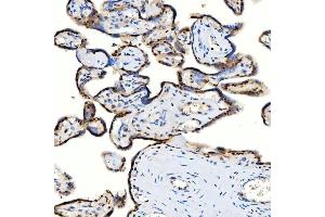 IHC analysis of U1-C/SNRPC using anti-U1-C/SNRPC antibody (ABIN7599016).