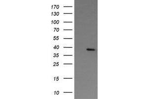 Image no. 1 for anti-Nudix (Nucleoside Diphosphate Linked Moiety X)-Type Motif 9 (NUDT9) antibody (ABIN1499875) (NUDT9 Antikörper)
