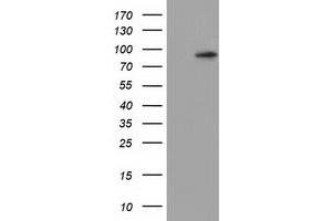 HEK293T cells were transfected with the pCMV6-ENTRY control (Left lane) or pCMV6-ENTRY CDCP1 (Right lane) cDNA for 48 hrs and lysed. (CDCP1 Antikörper)