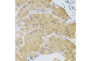 Immunohistochemistry of paraffin-embedded human stomach using SYK Antibody (ABIN5971150) at dilution of 1/100 (40x lens). (SYK Antikörper)