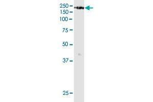 Western Blotting (WB) image for anti-Lysine (K)-Specific Demethylase 6A (KDM6A) (AA 641-740) antibody (ABIN948618)
