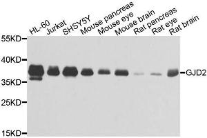 Western blot analysis of extracts of various cell lines, using GJD2 antibody. (GJD2 Antikörper  (AA 99-197))