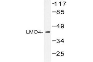 Western blot (WB) analysis of LMO4 antibody in extracts from 293 cells. (LMO4 Antikörper)