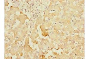 Immunohistochemistry of paraffin-embedded human liver tissue using ABIN7170776 at dilution of 1:100 (SOAT2 Antikörper  (AA 1-120))