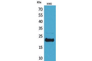 Western Blotting (WB) image for anti-Leukemia Inhibitory Factor (LIF) (C-Term) antibody (ABIN3178138) (LIF Antikörper  (C-Term))