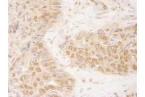 Immunohistochemistry (IHC) image for anti-Kinesin Family Member 2C (KIF2C) (AA 50-100) antibody (ABIN7448646) (KIF2C Antikörper  (AA 50-100))