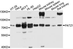 Western blot analysis of extracts of various cell lines, using PATZ1 antibody (ABIN4904681) at 1:1000 dilution. (PATZ1 Antikörper)