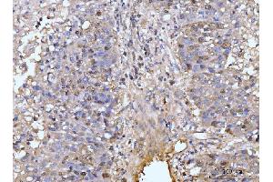 IHC analysis of HMGCS1 using anti-HMGCS1 antibody (ABIN7600928).