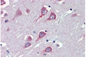 anti-Fatty Acid Amide Hydrolase (FAAH) (AA 566-577) antibody