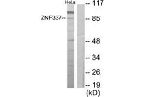 Western blot analysis of extracts from HeLa cells, using ZNF337 Antibody. (ZNF337 Antikörper  (AA 471-520))
