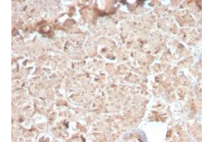 Formalin-fixed, paraffin-embedded human Pancreas stained with CELA3B Rabbit Recombinant Monoclonal Antibody (CELA3B/2810R). (Rekombinanter Elastase 3B Antikörper  (AA 82-238))