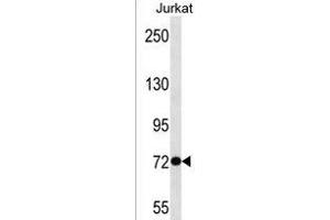 ANKRD56 Antibody (Center) (ABIN1538405 and ABIN2850334) western blot analysis in Jurkat cell line lysates (35 μg/lane). (SOWAHB Antikörper  (AA 412-438))