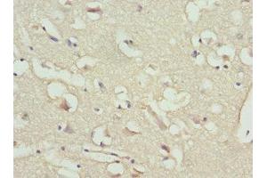 IHC analysis of paraffin-embedded human brain tissue, using NT-proBNP antibody (1/100 dilution).