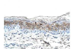 Fibrinogen Alpha antibody was used for immunohistochemistry at a concentration of 4-8 ug/ml to stain Squamous epithelial cells (arrows) in Human Skin. (FGA Antikörper  (N-Term))