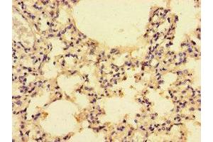Immunohistochemistry of paraffin-embedded human lung tissue using ABIN7146002 at dilution of 1:100 (CCL4 Antikörper  (AA 24-84))