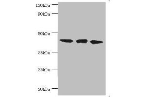 Western blot All lanes: TAR DNA-binding protein 43 antibody at 8 μg/mL Lane 1: Hela whole cell lysate Lane 2: Mouse spleen tissue Lane: K562 whole cell lysate Secondary Goat polyclonal to rabbit IgG at 1/10000 dilution Predicted band size: 45, 32 kDa Observed band size: 45 kDa (TARDBP Antikörper  (AA 1-260))