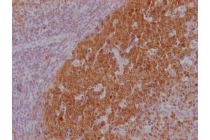 IHC image of ABIN7180562 diluted at 1:100 and staining in paraffin-embedded human lymph node tissue performed on a Leica BondTM system. (POU2AF1 Antikörper)