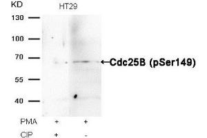 Western blot analysis of extracts from HT29 cells, treated with PMA or calf intestinal phosphatase (CIP), using Cdc25B (Phospho-Ser149) Antibody. (CDC25B Antikörper  (pSer149))