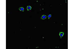 Immunofluorescence (IF) image for anti-Transforming Growth Factor, beta Receptor II (70/80kDa) (TGFBR2) (AA 25-159) antibody (ABIN7171961)