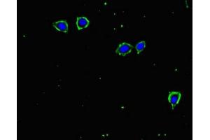 Immunofluorescent analysis of MCF-7 cells using ABIN7171961 at dilution of 1:100 and Alexa Fluor 488-congugated AffiniPure Goat Anti-Rabbit IgG(H+L) (TGFBR2 Antikörper  (AA 25-159))