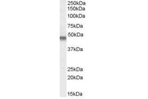 Image no. 1 for anti-Potassium Inwardly-Rectifying Channel, Subfamily J, Member 11 (KCNJ11) (Internal Region), (N-Term) antibody (ABIN374886) (KCNJ11 Antikörper  (Internal Region, N-Term))