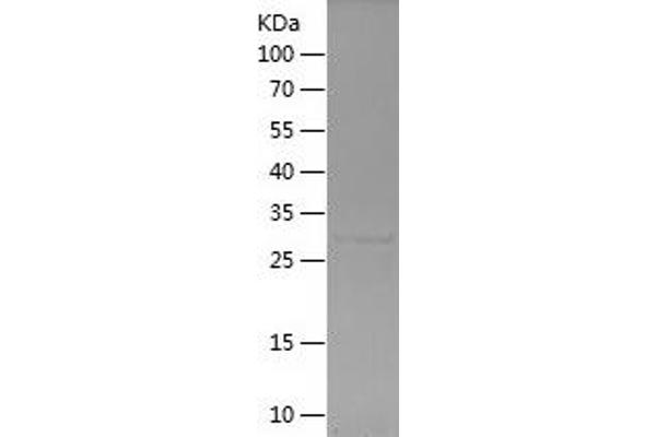 Keratin 6B Protein (KRT6B) (AA 5-90) (His-IF2DI Tag)