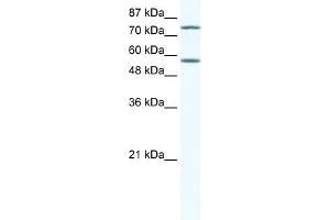 WB Suggested Anti-IRF4 Antibody Titration:  5ug/ml  Positive Control:  Jurkat cell lysate (IRF4 Antikörper  (N-Term))
