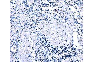 Immunohistochemistry (IHC) image for anti-DNA (Cytosine-5-)-Methyltransferase 3 alpha (DNMT3A) antibody (ABIN1872325) (DNMT3A Antikörper)
