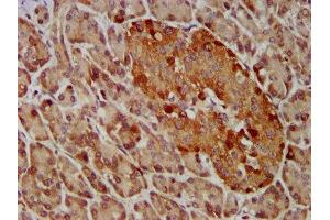 IHC image of ABIN7153757 diluted at 1:400 and staining in paraffin-embedded human pancreatic tissue performed on a Leica BondTM system. (GEMIN4 Antikörper  (AA 741-848))