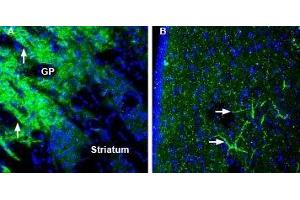 Expression of SynGAP in mouse globus pallidus and rat lateral septum - Immunohistochemical staining of perfusion-fixed frozen mouse and rat brain sections using Anti-SynGAP Antibody (ABIN7043789, ABIN7045176 and ABIN7045177), (1:200), followed by goat-anti-rabbit-AlexaFluor-488. (SYNGAP1 Antikörper  (C-Term))