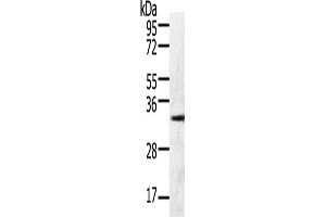 Gel: 10 % SDS-PAGE, Lysate: 60 μg, Lane: 293T cells, Primary antibody: ABIN7190790(GFRA4 Antibody) at dilution 1/600, Secondary antibody: Goat anti rabbit IgG at 1/8000 dilution, Exposure time: 30 seconds (GFRA4 Antikörper)