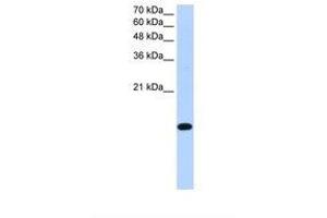 Image no. 1 for anti-Basic Leucine Zipper Transcription Factor, ATF-Like 2 (BATF2) (AA 116-165) antibody (ABIN6739212) (BATF2 Antikörper  (AA 116-165))