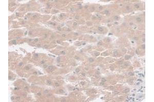IHC-P analysis of Human Liver Tissue, with DAB staining. (SYNE2 Antikörper  (AA 6-296))