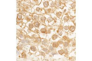 anti-CDC42 Effector Protein (Rho GTPase Binding) 4 (CDC42EP4) (AA 250-300) antibody