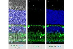 Indirect immunostaining of mouse retina (dilution 1 : 500). (CPLX3 Antikörper)