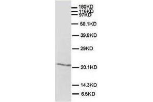 Western blot analysis of rat brain tissue lysis using SHH antibody (Sonic Hedgehog Antikörper  (N-Term))