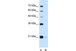 Western Blotting (WB) image for anti-DCTP Pyrophosphatase 1 (DCTPP1) antibody (ABIN2462972)