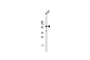 Anti-TGFBR1 Antibody (Center) at 1:2000 dilution + A431 whole cell lysate Lysates/proteins at 20 μg per lane. (TGFBR1 Antikörper  (AA 145-172))