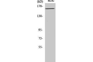 Western Blot (WB) analysis of specific cells using Phospho-Flk-1 (Y1175) Polyclonal Antibody. (VEGFR2/CD309 Antikörper  (pTyr1175))