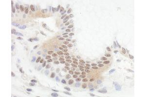 Immunohistochemistry (IHC) image for anti-B-Cell CLL/lymphoma 11B (Zinc Finger Protein) (BCL11B) (AA 500-550) antibody (ABIN7454621) (BCL11B Antikörper  (AA 500-550))