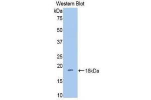 Western Blotting (WB) image for anti-Dipeptidyl-Peptidase 4 (DPP4) (AA 631-760) antibody (ABIN1858663) (DPP4 Antikörper  (AA 631-760))