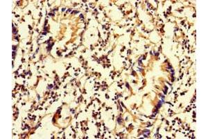Immunohistochemistry of paraffin-embedded human appendix tissue using ABIN7150849 at dilution of 1:100 (DNAAF3 Antikörper  (AA 1-209))