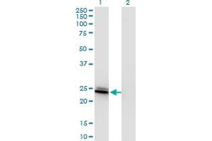 Western Blot analysis of BIN3 expression in transfected 293T cell line by BIN3 monoclonal antibody (M09), clone 4E12.