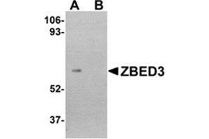 Western blot analysis of ZBED3 in human lung tissue lysate with this product at 1 μg/ml in (A) the absence and (B) the presence of blocking peptide.