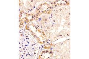 Antibody staining PKC beta1/2 in human kidney tissue sections by Immunohistochemistry (IHC-P - paraformaldehyde-fixed, paraffin-embedded sections). (PKC beta1/2 (AA 303-334) Antikörper)