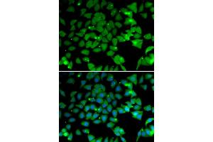 Immunofluorescence analysis of U2OS cells using NAA10 antibody (ABIN5974216). (NAA10 Antikörper)