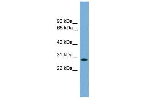WB Suggested Anti-APOLD1 Antibody Titration:  0. (APOLD1 Antikörper  (Middle Region))