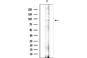Western blot analysis of lysates from EC304 cells(heat-shock treatment), using RHG6 Antibody at 1/1000 dilution. (RHG6 (Internal Region) Antikörper)